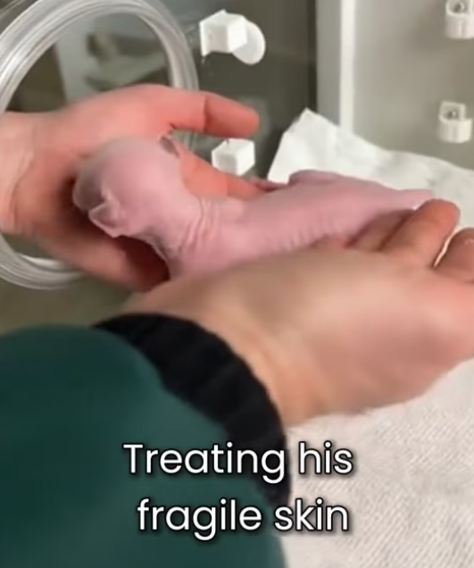 F1803010 Nature Rejected Him Because He Was Different (Part 2)