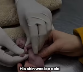 F2903005 He Was Born Hairless and His Mother Rejected Him.. Look at Him Know!! (Part 2)